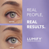 LUMIFY Redness Reliever Eye Drops, 7.5ml